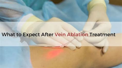 what to expect after a blown vein